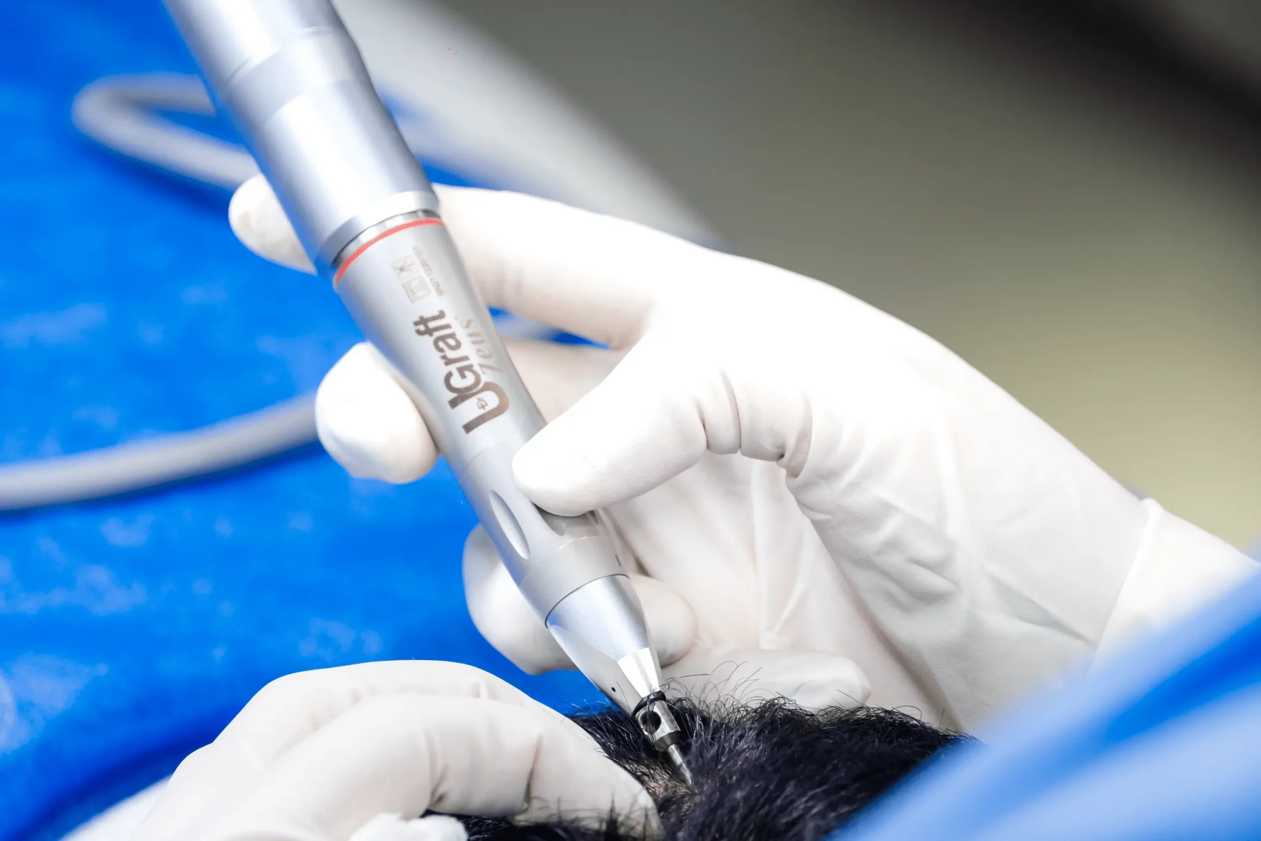 TRATAMIENTOS - Capil Clinic